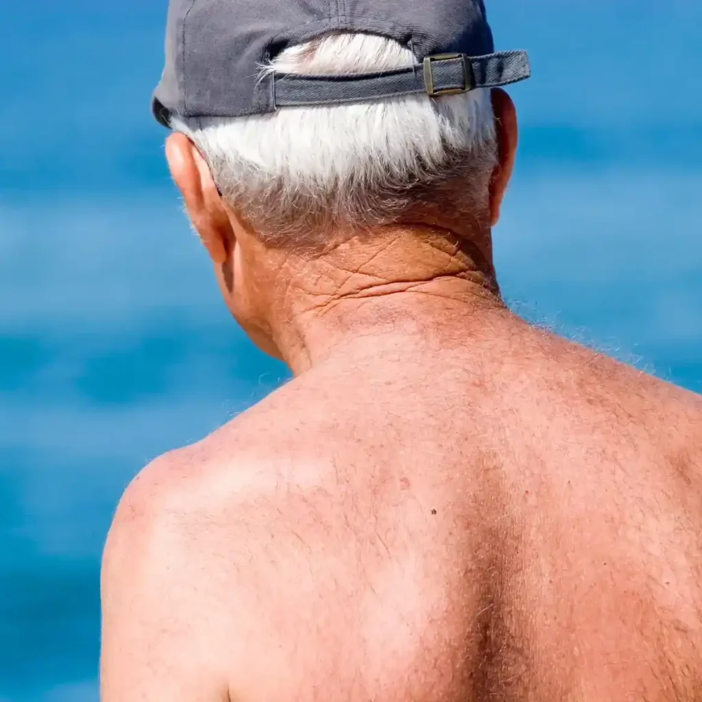 Photodynamic therapy Munich Sendlinger Tor