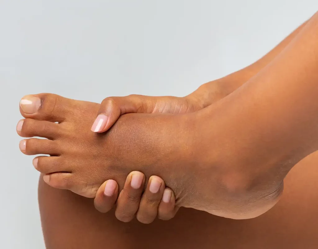 Fungal infection of the skin Sendlinger Tor cropped-of-black-girl-rubbing-her-foot-2025-03-18-18-28-07-utc