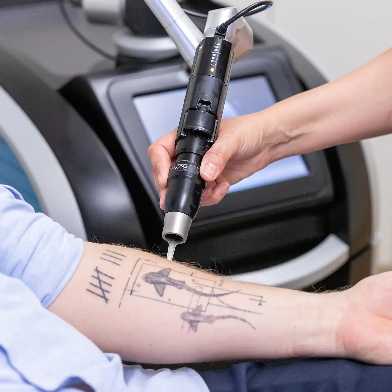 Laser Medicine PicoSure Dermatology Munich Sendlinger Tor