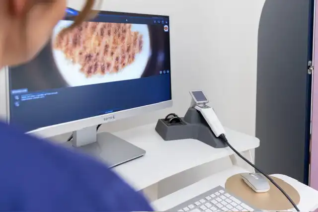 Skin cancer screening Dermatology at Sendlinger Tor