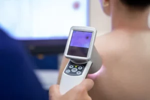 skin cancer screening dermatology munich sendlinger tor