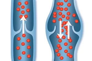 venous valve dermatology sendlinger tor