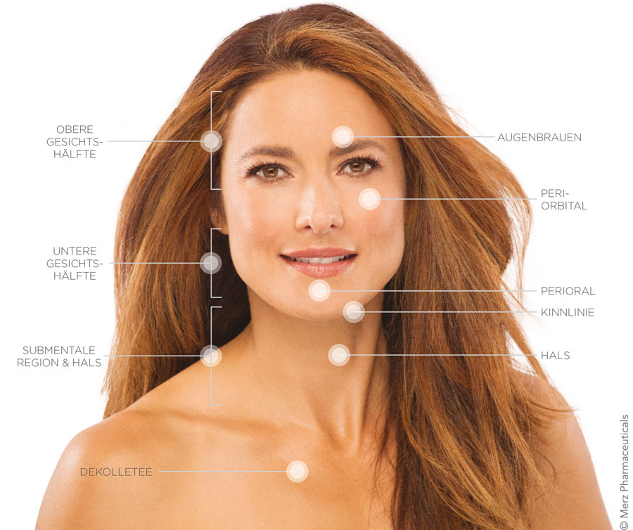 Ultherapy Behandlungsareale